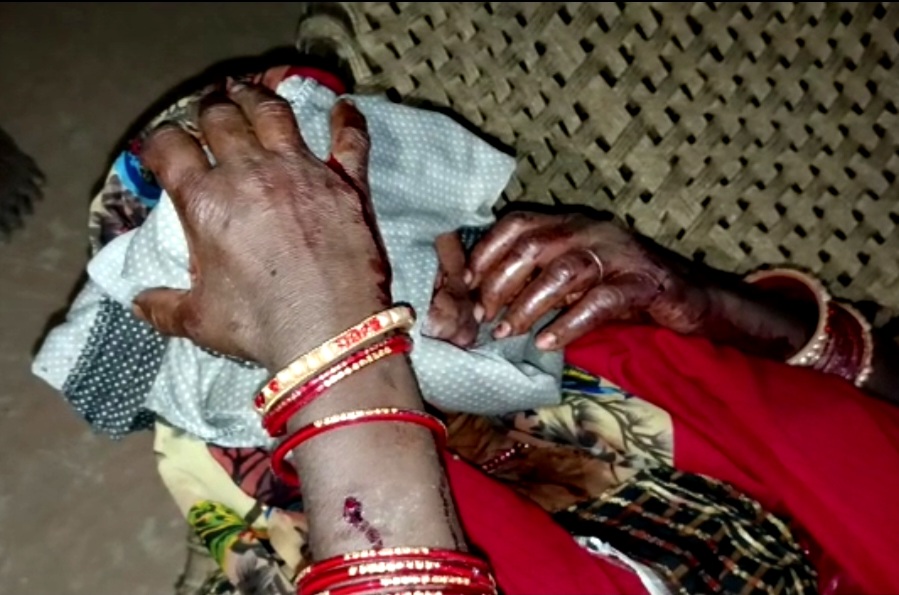 गांव में घुसा तेंदुआ , कइयों को किया घायल 