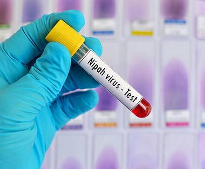 Kerala:  राहत की खबर, केरल में पिछले चार दिनों से नहीं आया एक भी Nipah Virus केस